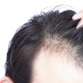 What vitamins cause rapid hair growth?