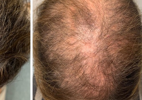 Are there any hair growth supplements that actually work?