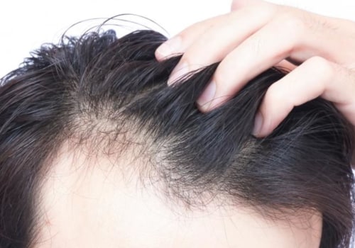 What vitamins cause rapid hair growth?